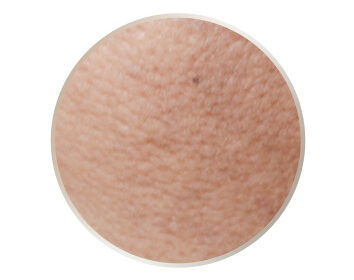 水飛梭海菲秀適用對象－膚色黯沉不均