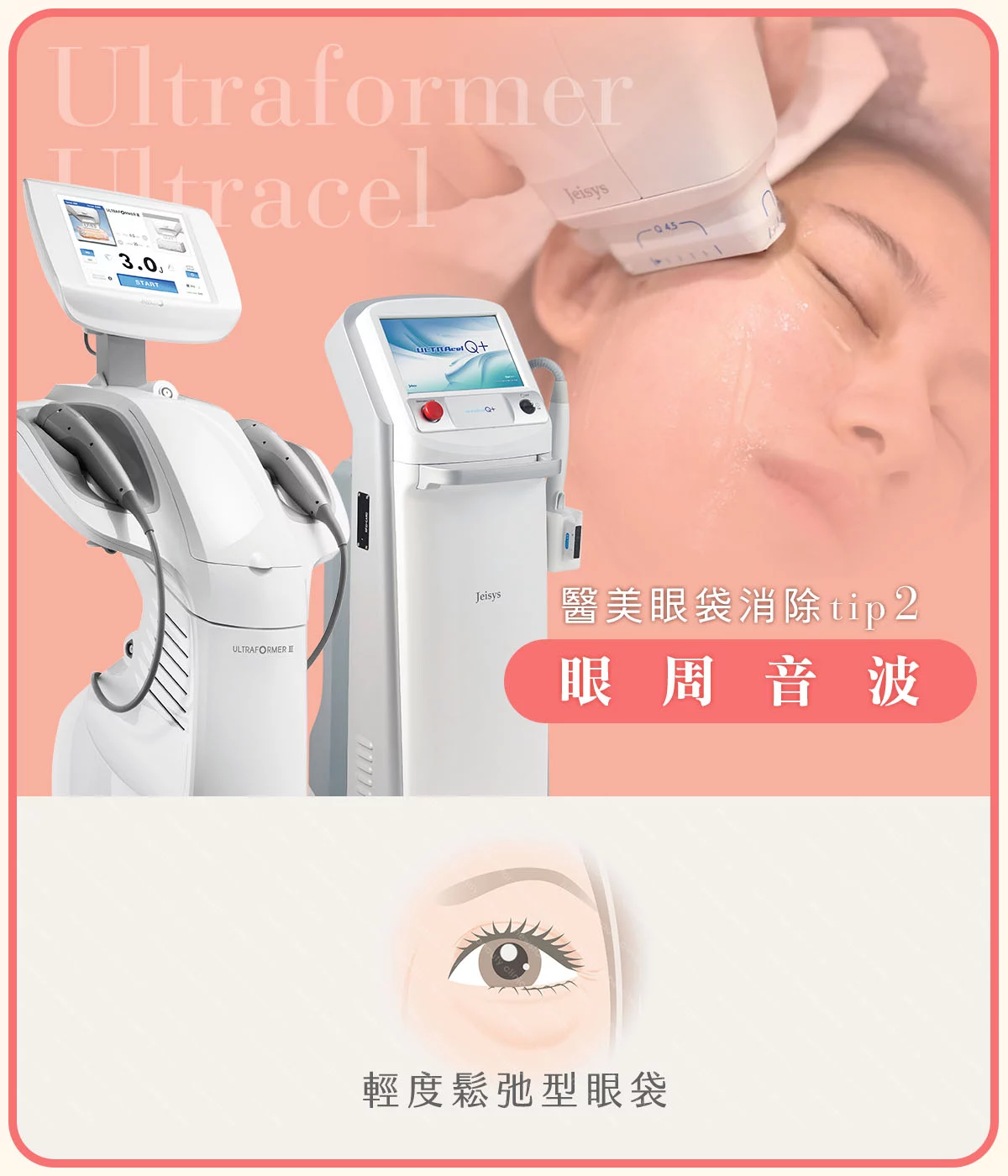 醫美眼袋消除方法