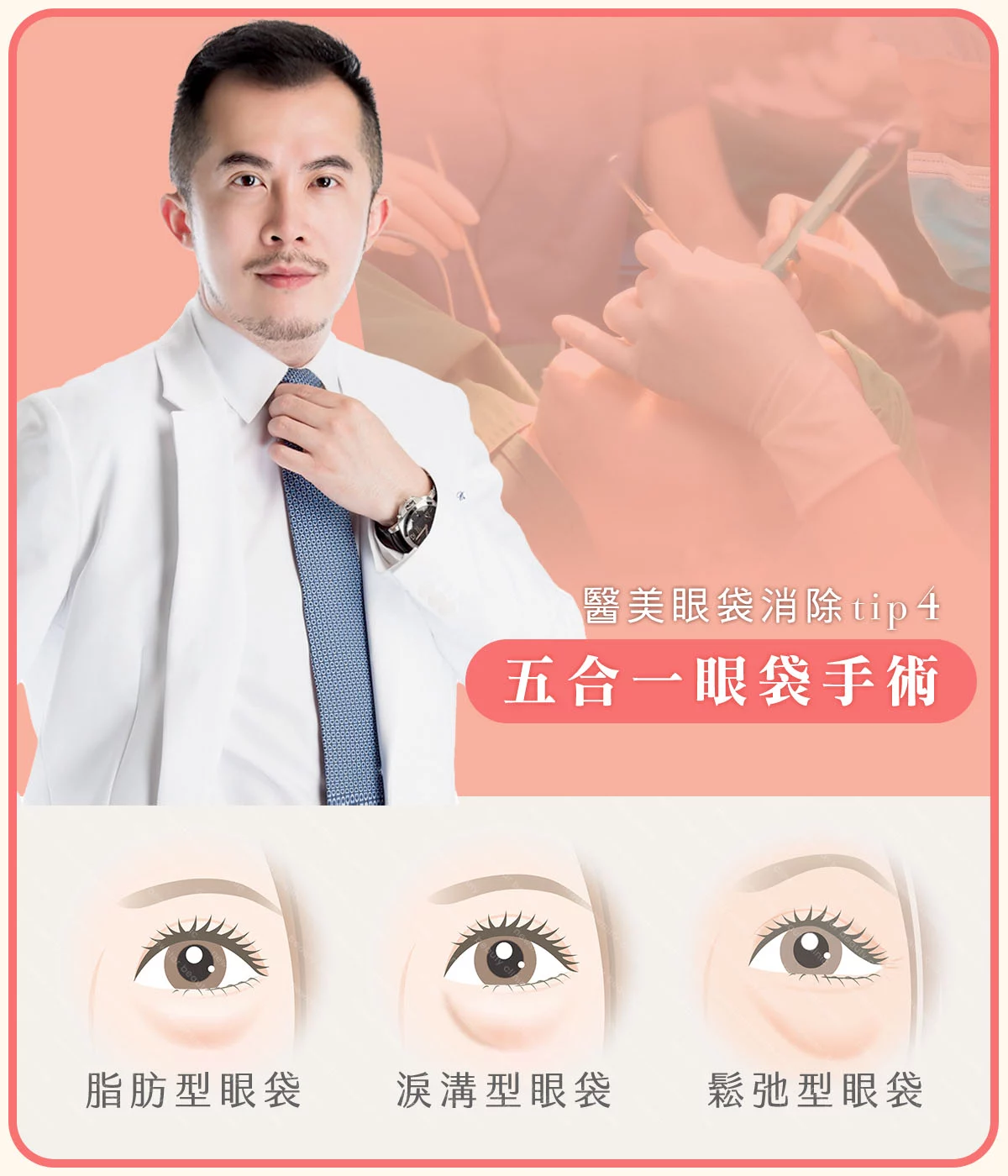 醫美眼袋消除方法