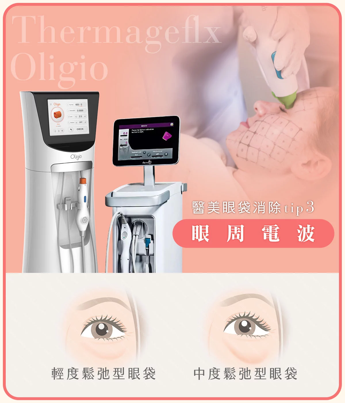 醫美眼袋消除方法
