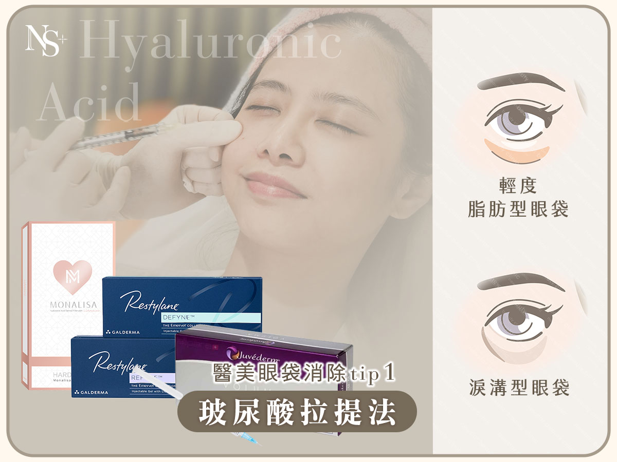 醫美眼袋消除方法_玻尿酸拉提