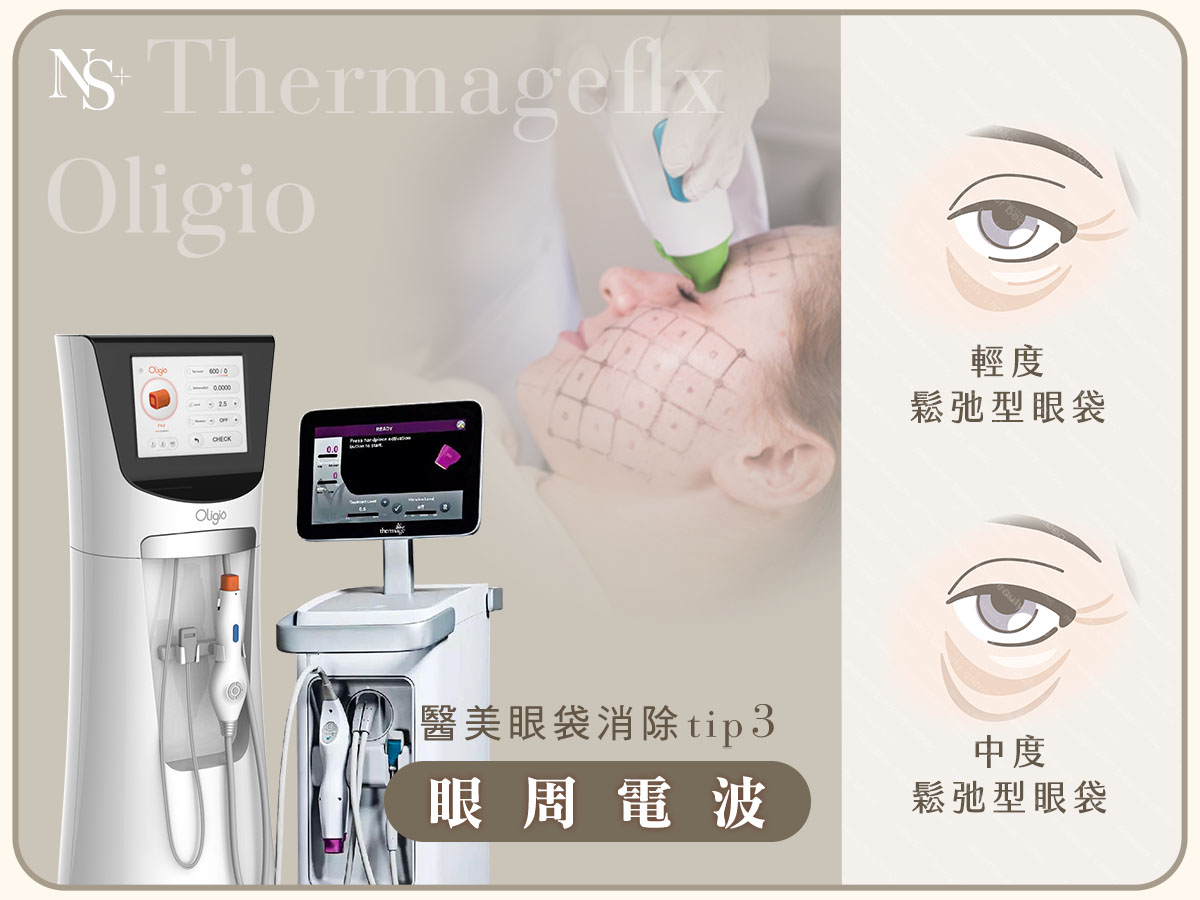 醫美眼袋消除方法_眼周電波