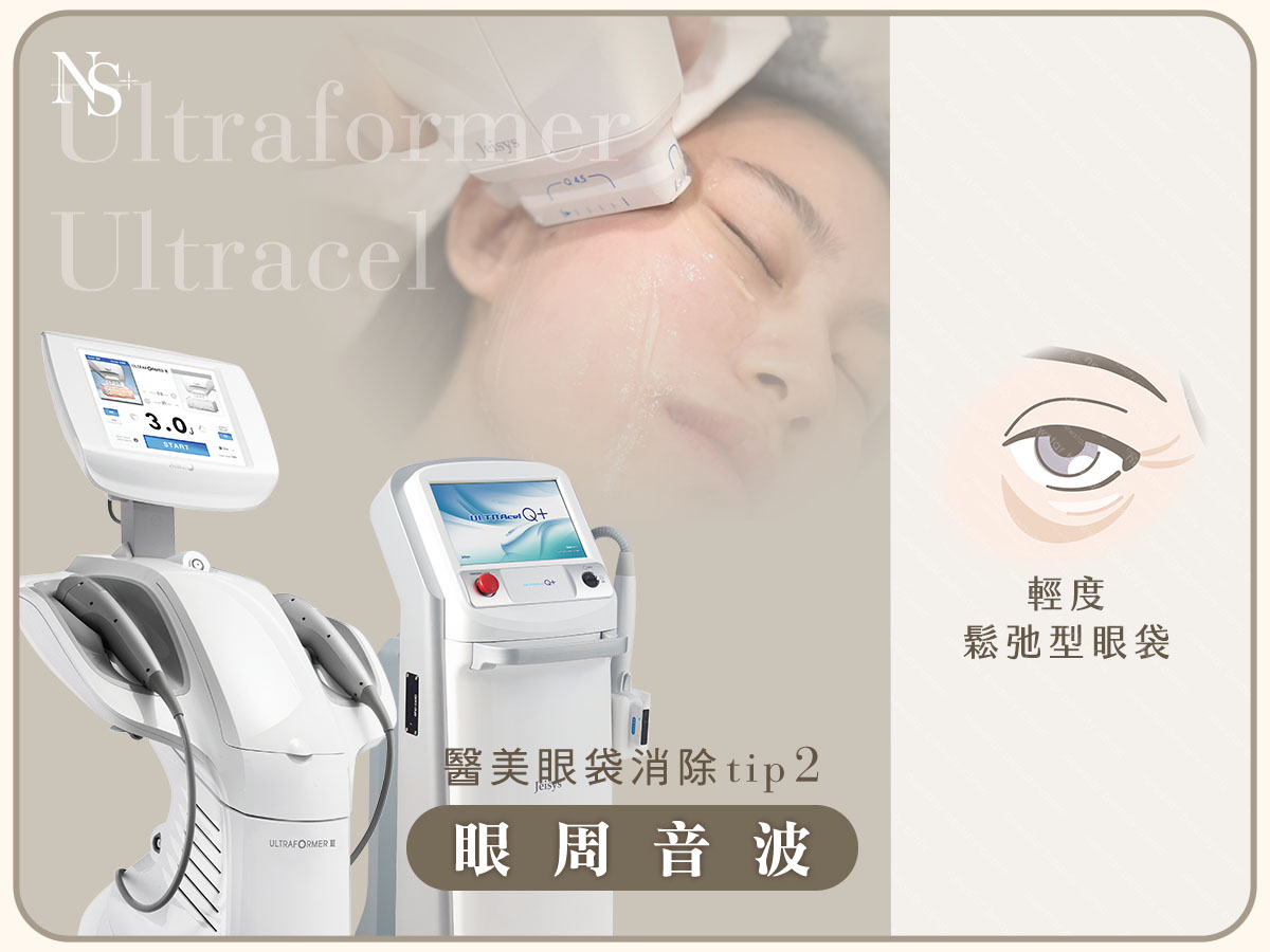 醫美眼袋消除方法_眼周音波
