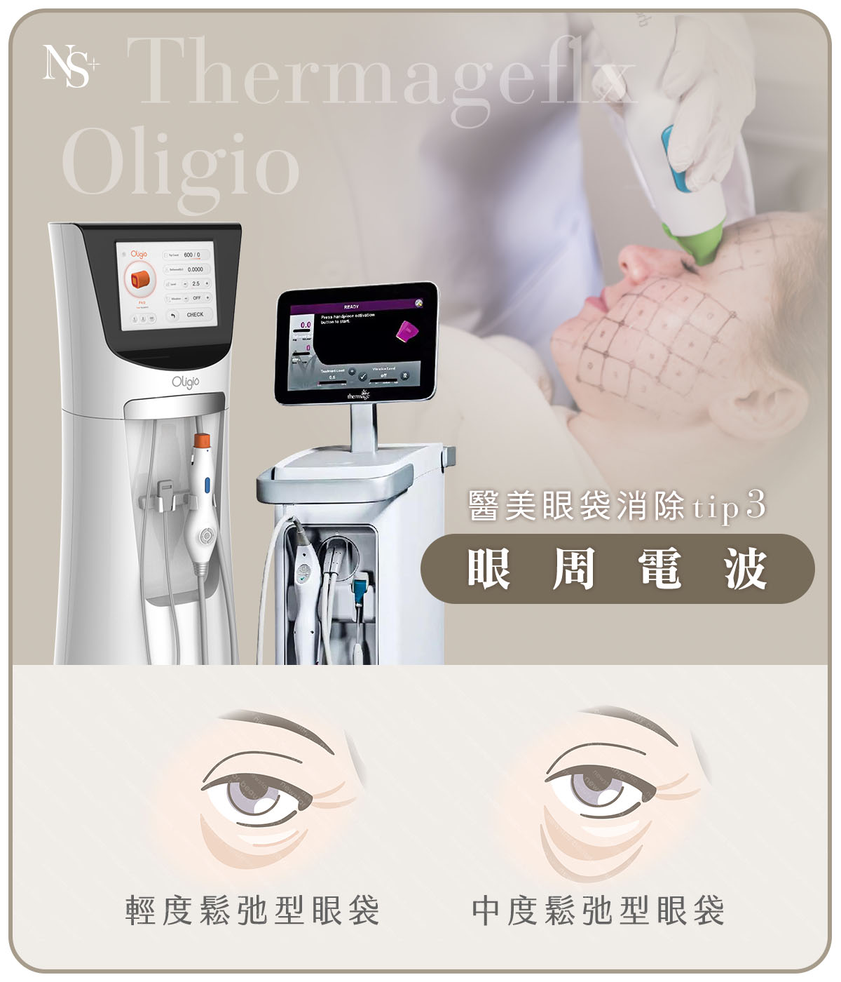 醫美眼袋消除方法(手機)_眼周電波