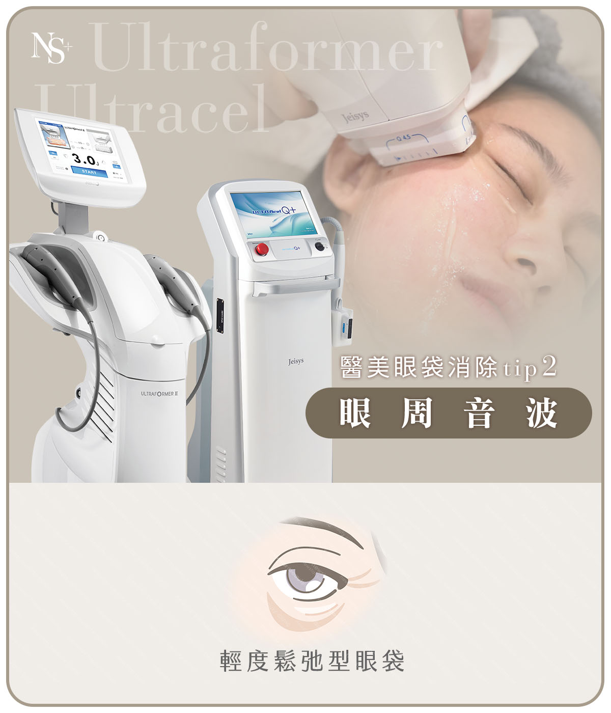 醫美眼袋消除方法(手機)_眼周音波