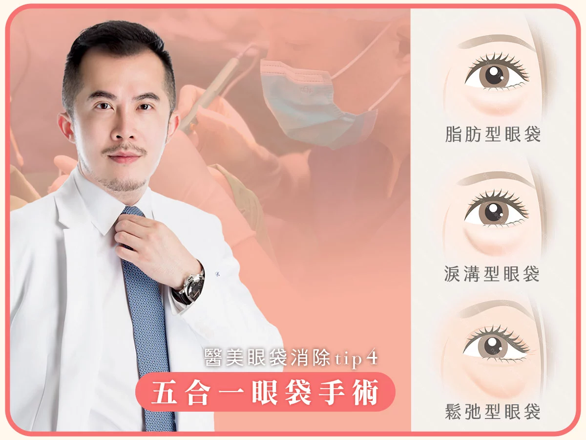醫美眼袋消除方法