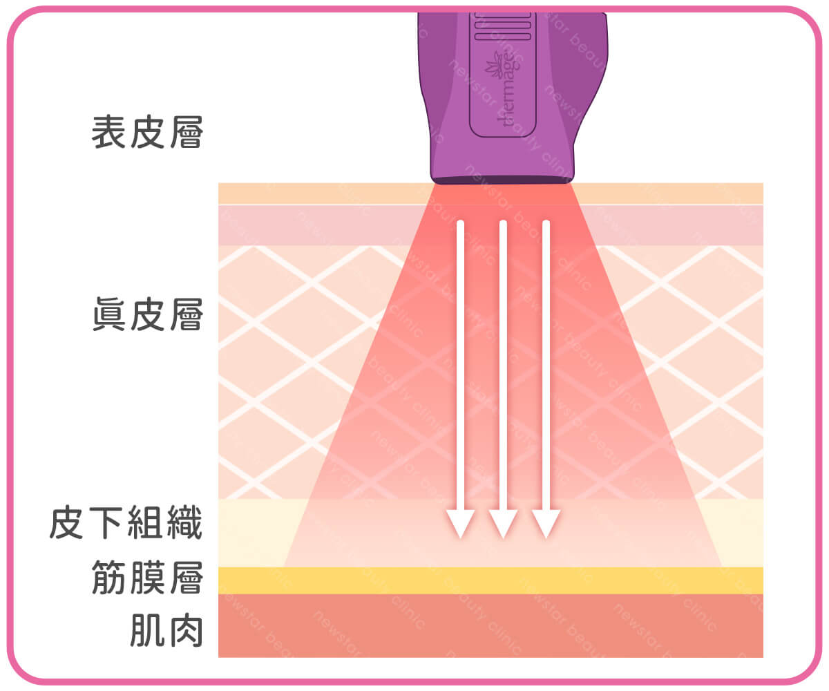 鳳凰電波_原理