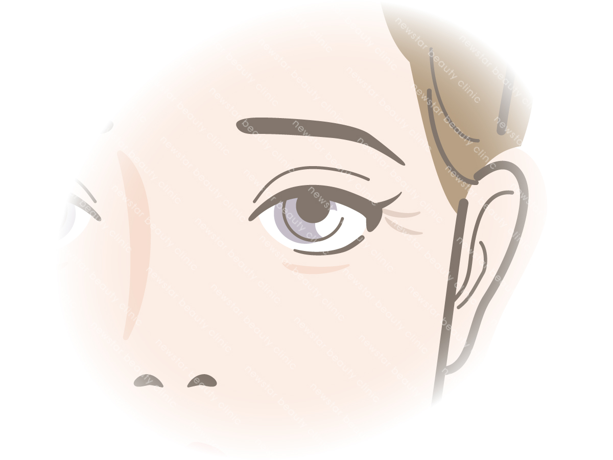 鳳凰電波_適應對象01