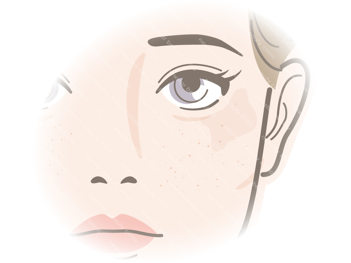 鳳凰電波_適應對象03