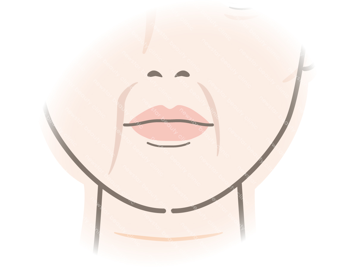 鳳凰電波_適應對象2