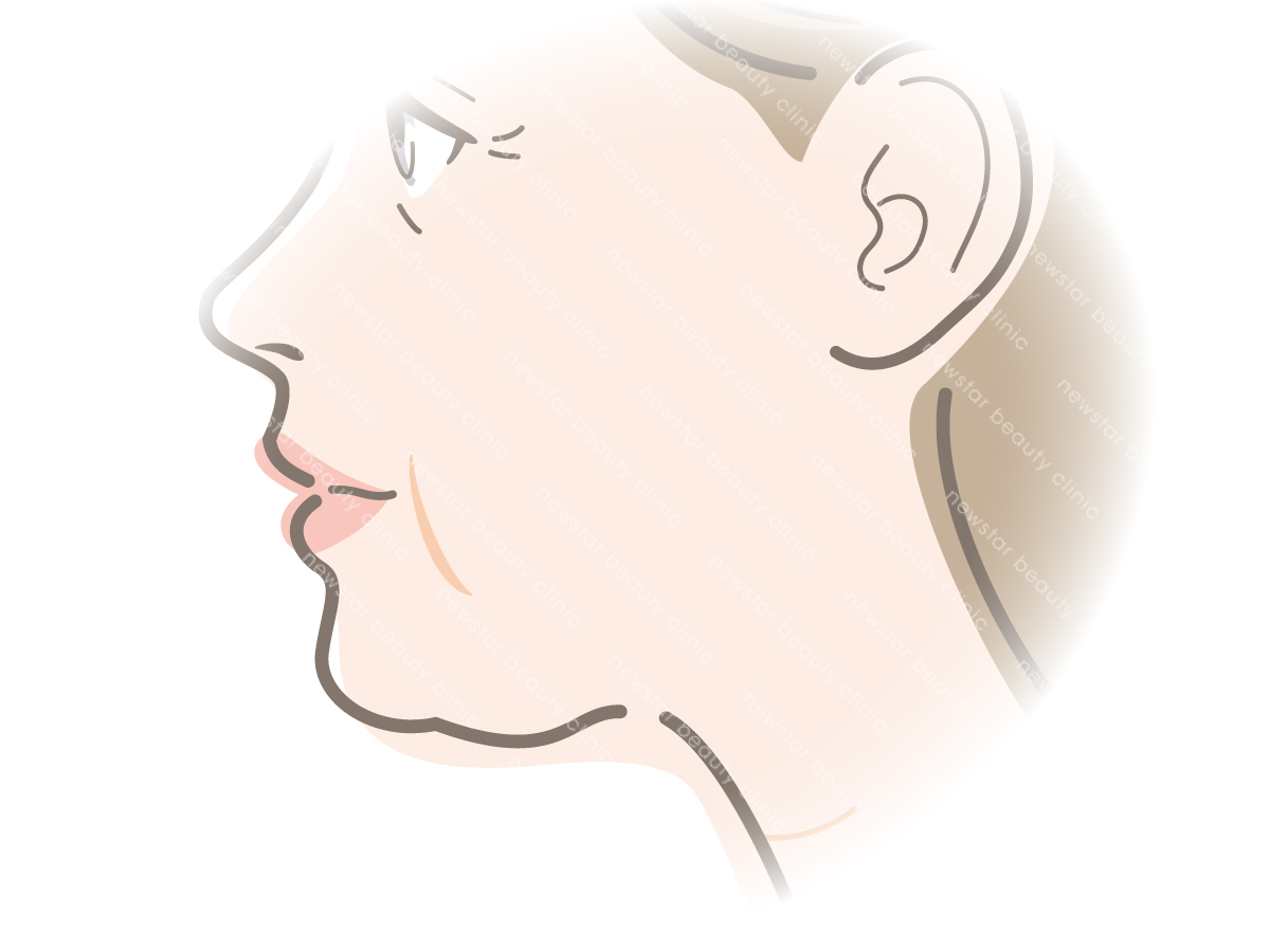 鳳凰電波_適應對象4