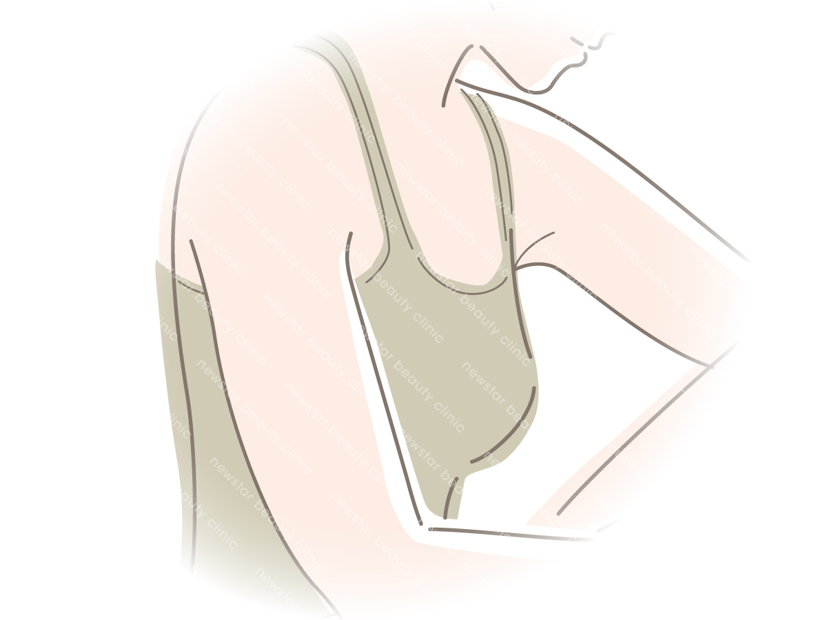 鳳凰電波_適應對象5