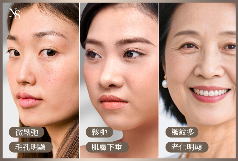 鳳凰電波_需要音波還是電波_年齡膚況