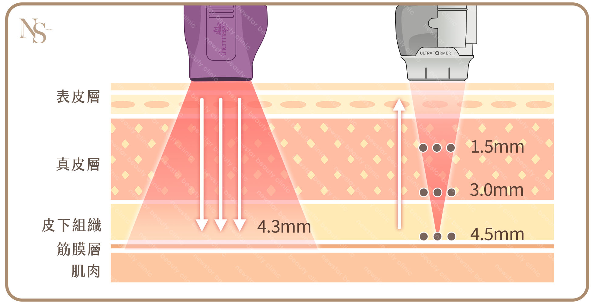 鳳凰電波_電音波原理