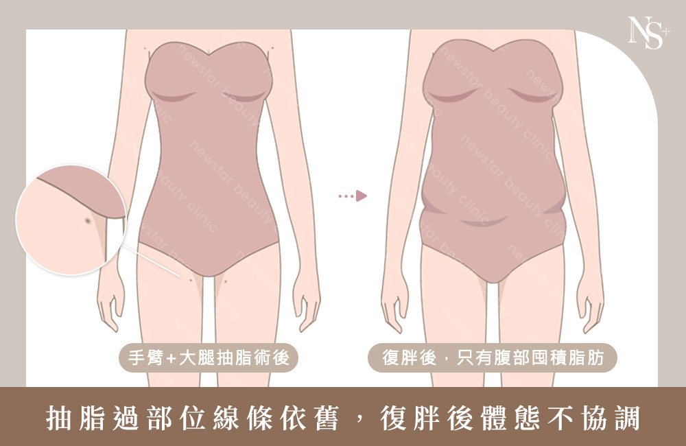 復胖體態不協調04