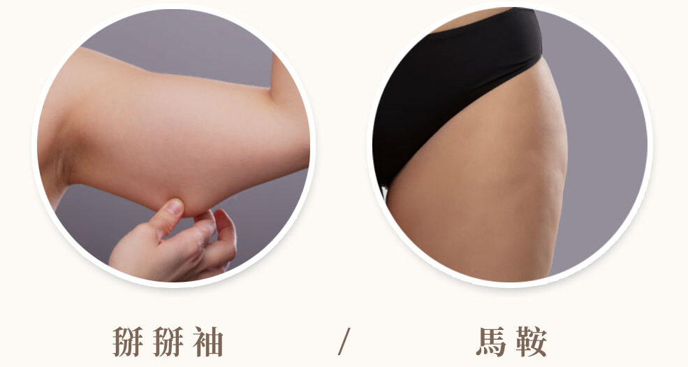 抽脂迷思_抽脂部位