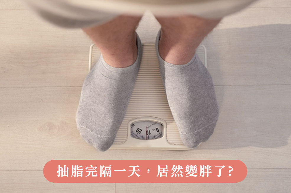 抽脂復胖