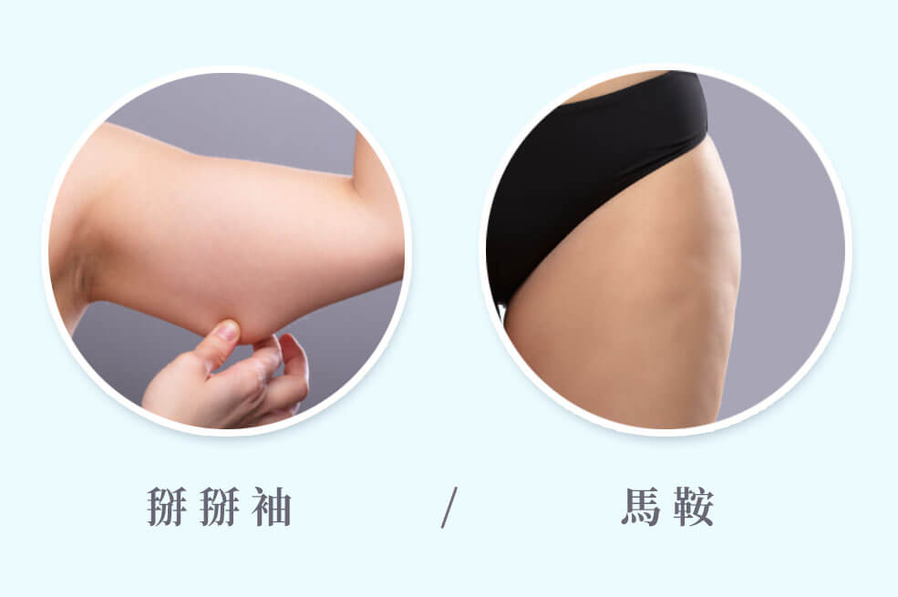 抽脂復胖_部位
