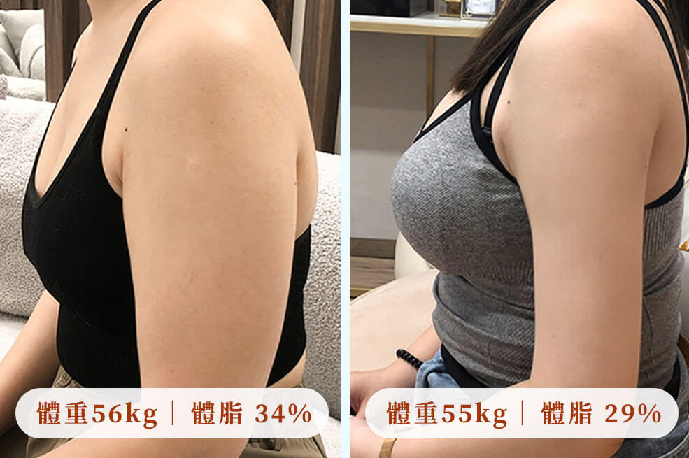 抽脂復胖_體脂肪比較