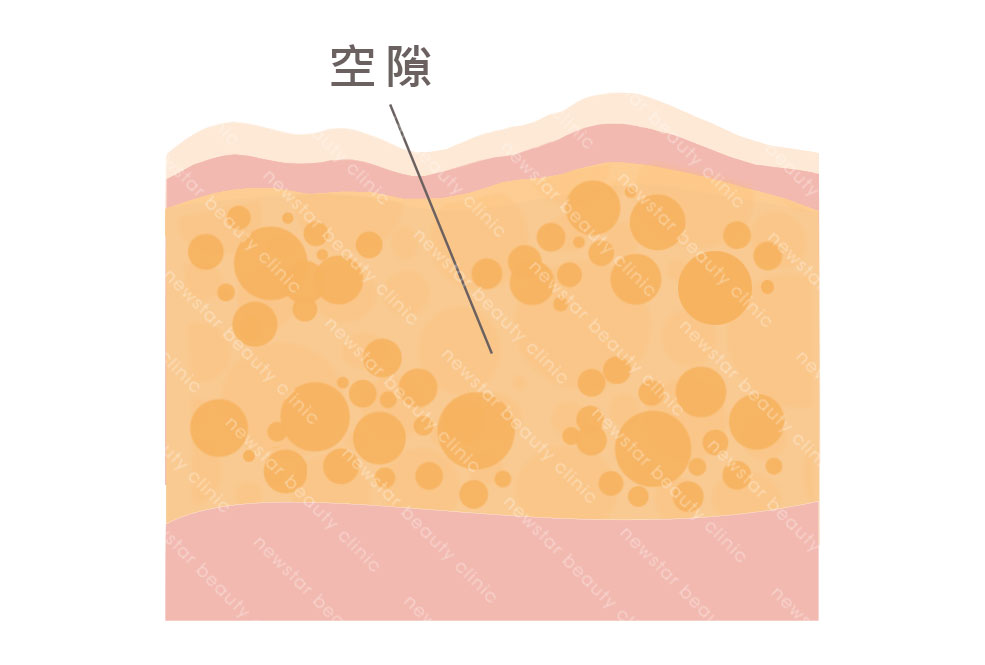 單張脂肪層(新版)_空隙