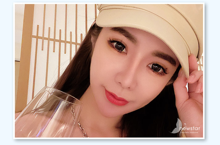 玻尿酸_案例封面(采)