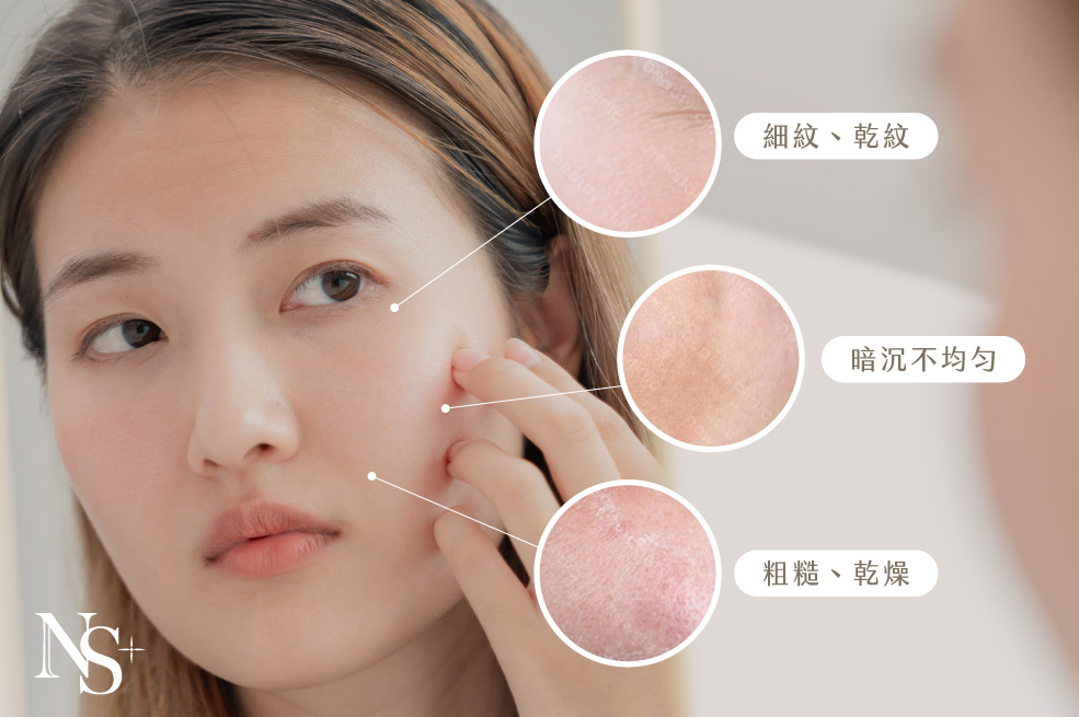 玻尿酸_皮膚老化狀況