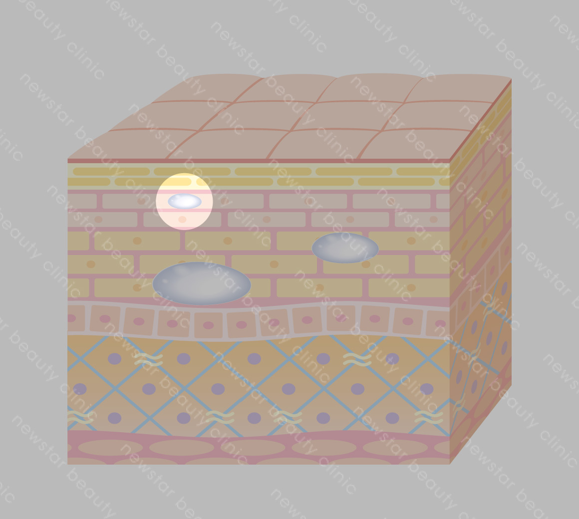 玻尿酸位置-小分子