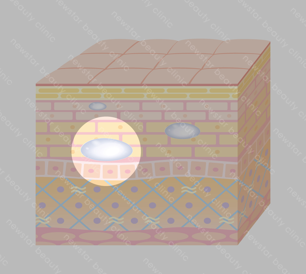 玻尿酸位置_大分子