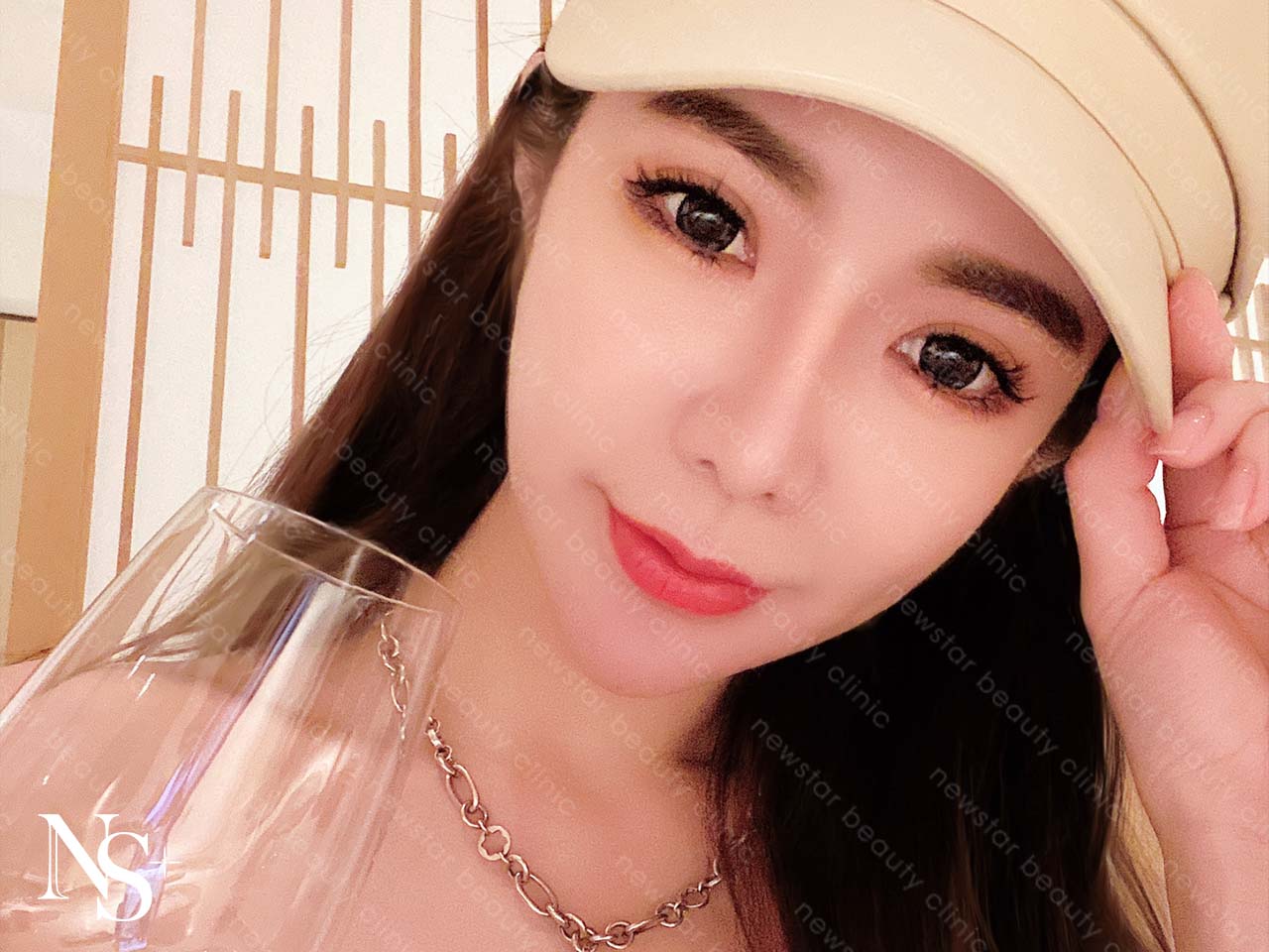 玻尿酸注射_欣莘醫美_好評回饋