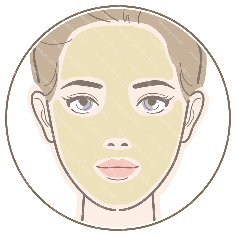 玻尿酸適合對象_欲加強皮膚保溼者