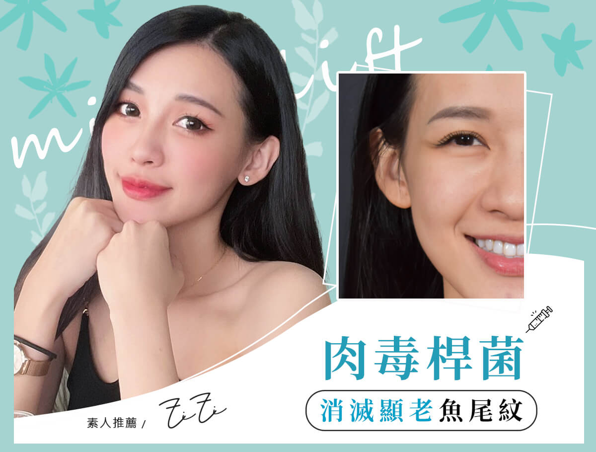 肉毒除皺_案例封面