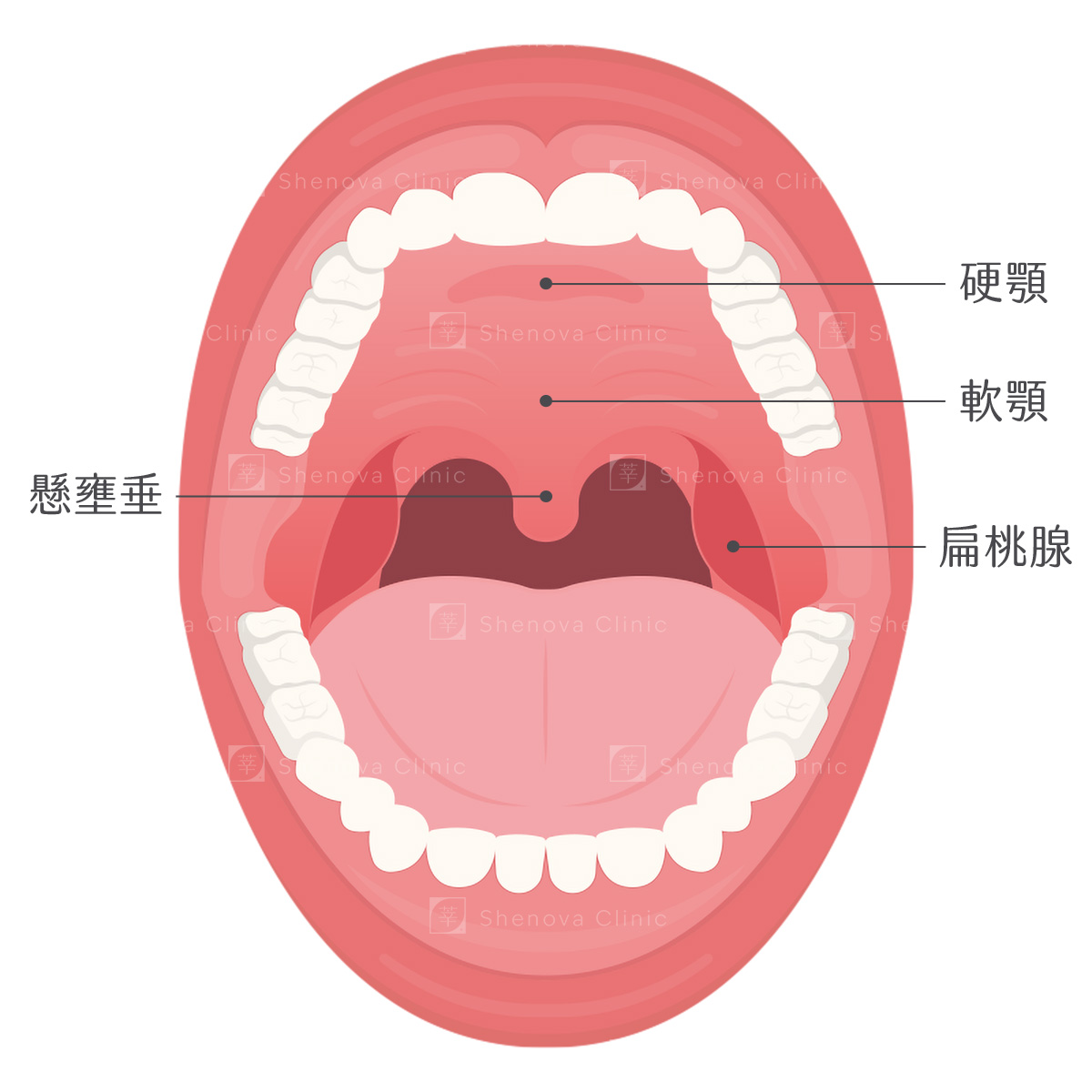 軟硬顎、扁桃腺、懸壅垂位置圖