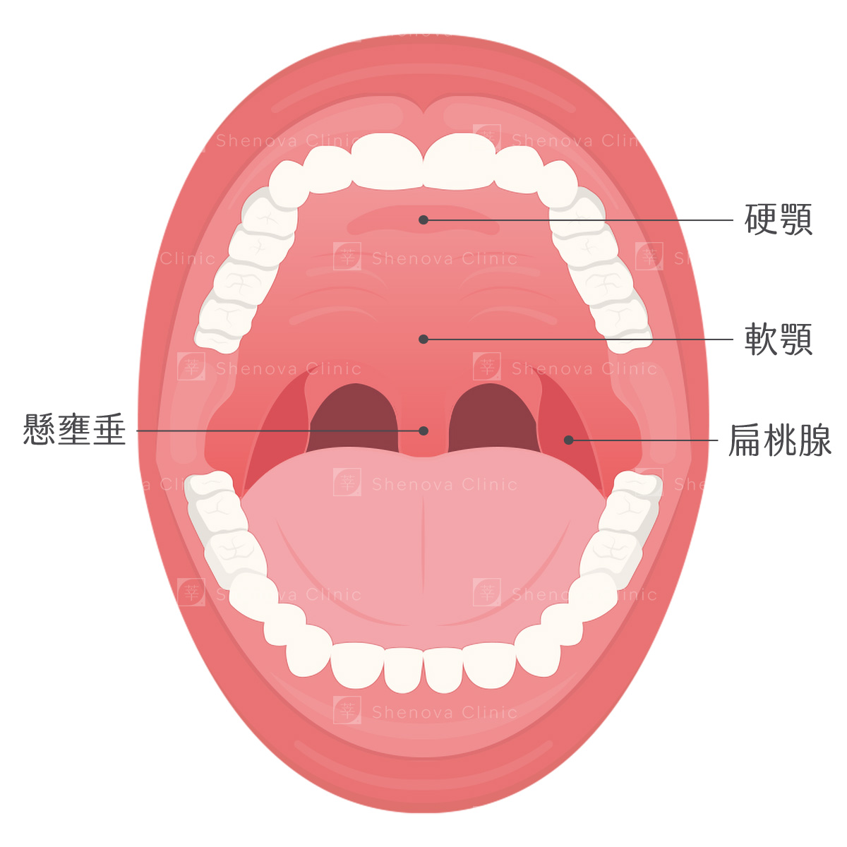 軟硬顎、扁桃腺、懸壅垂位置圖
