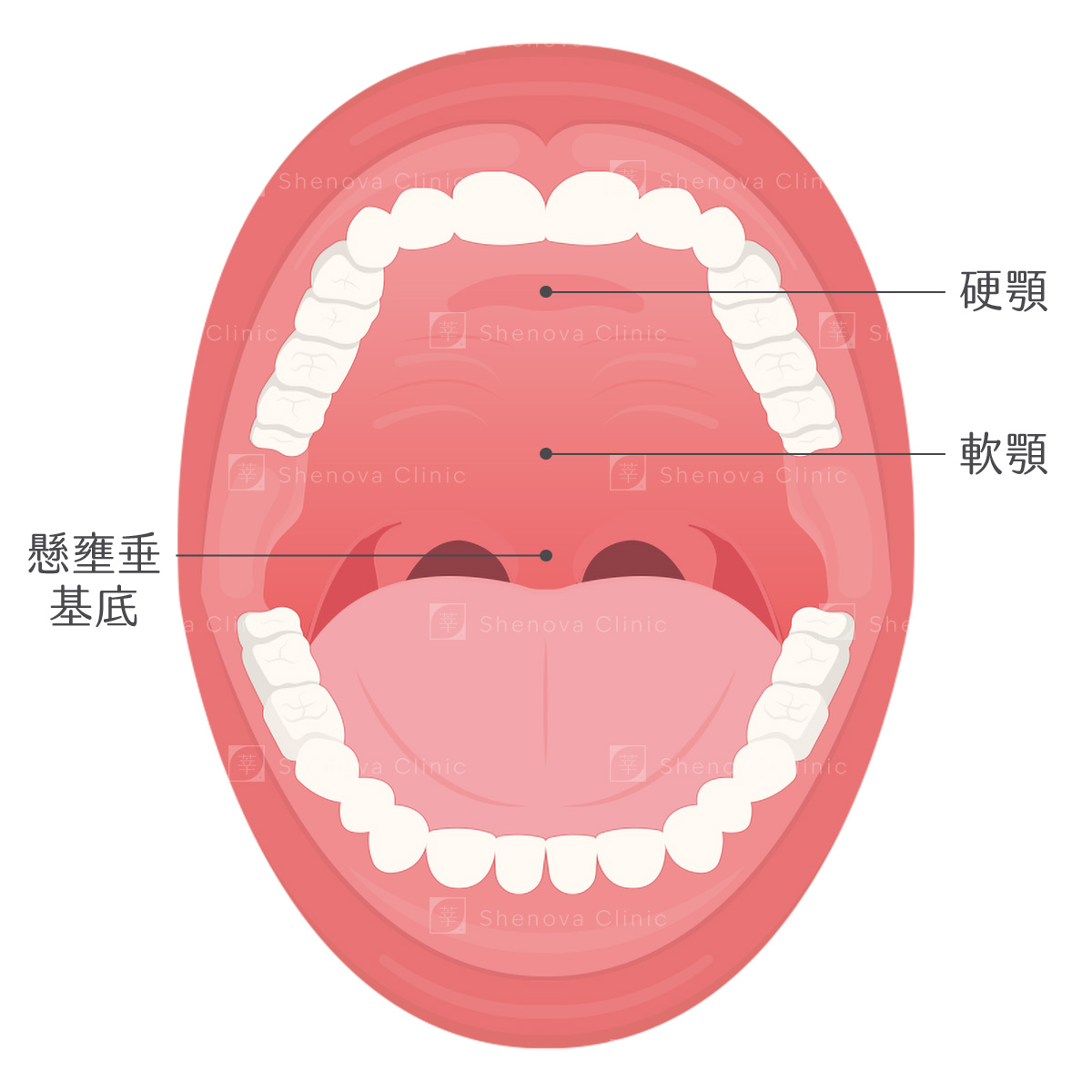 軟硬顎、扁桃腺、懸壅垂位置圖