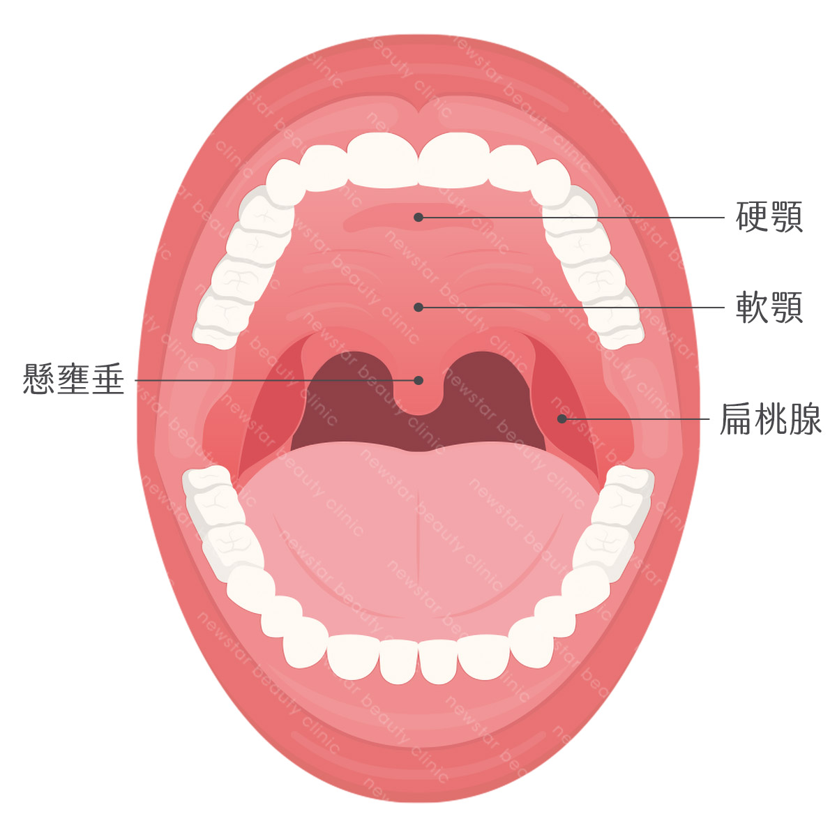 軟硬顎、扁桃腺、懸壅垂位置圖