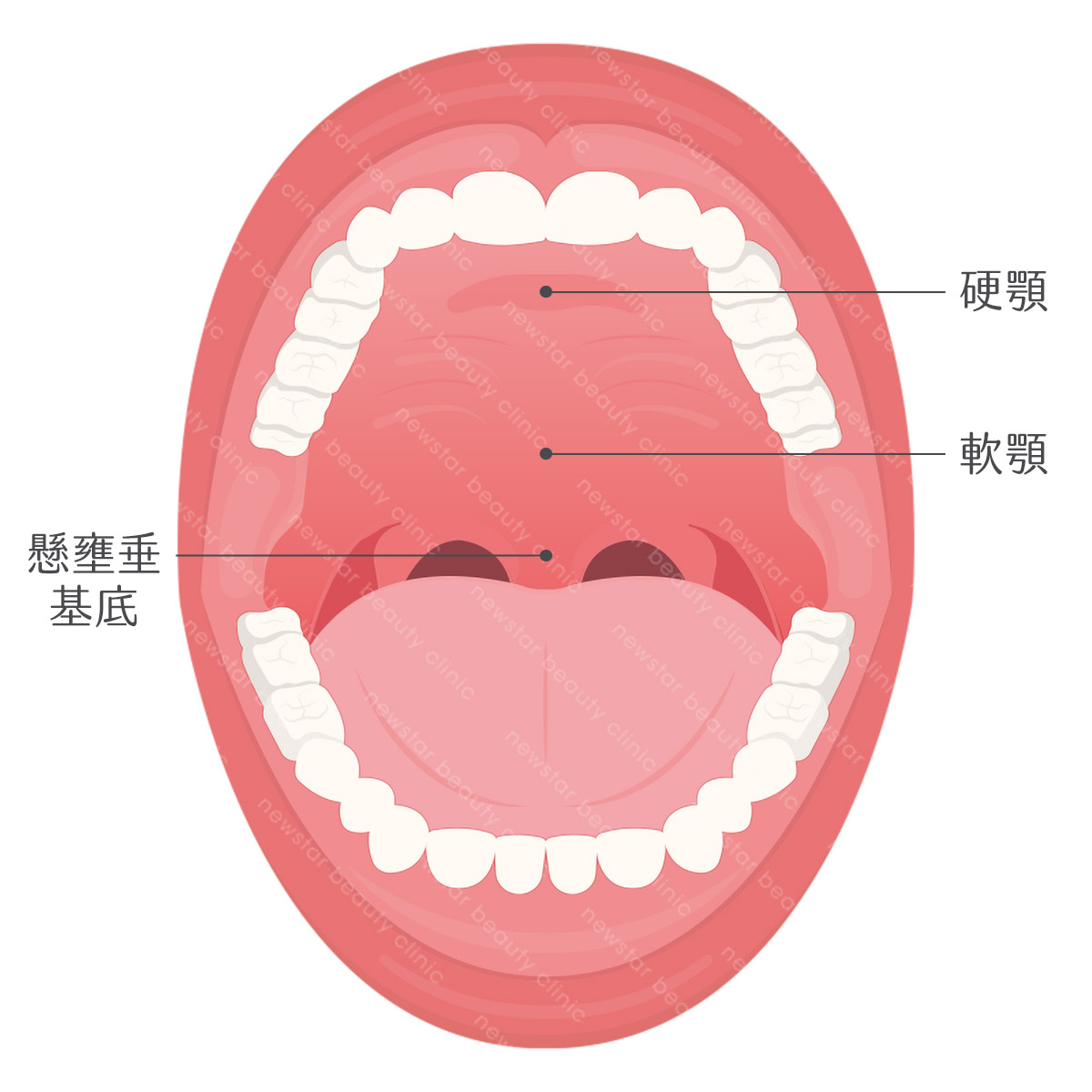 軟硬顎、扁桃腺、懸壅垂位置圖