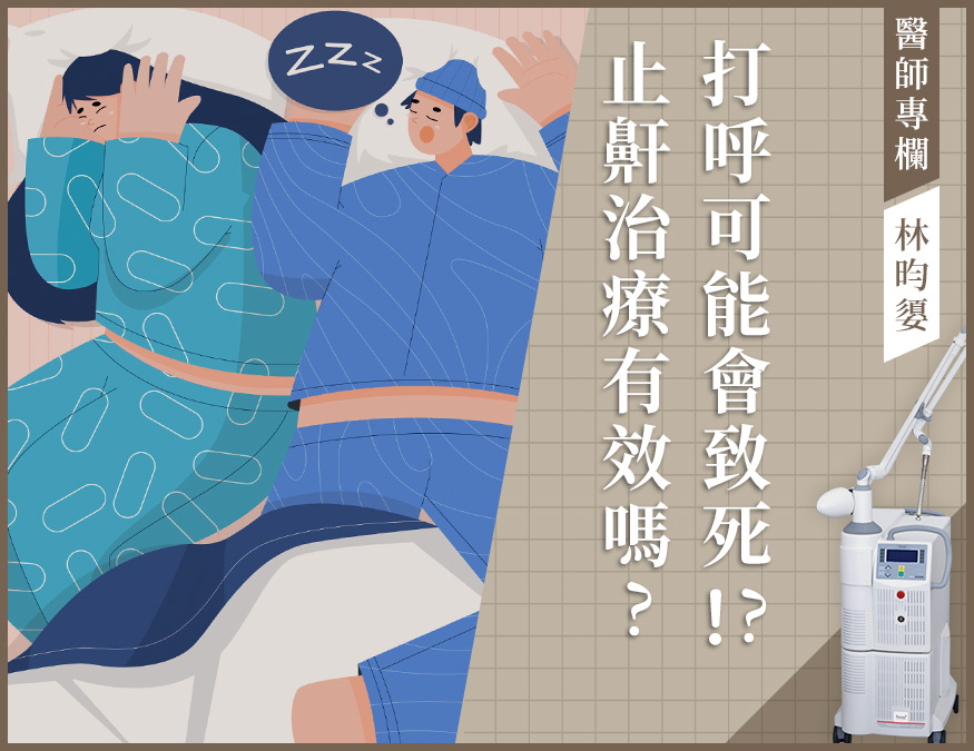 止鼾雷射_外bn01
