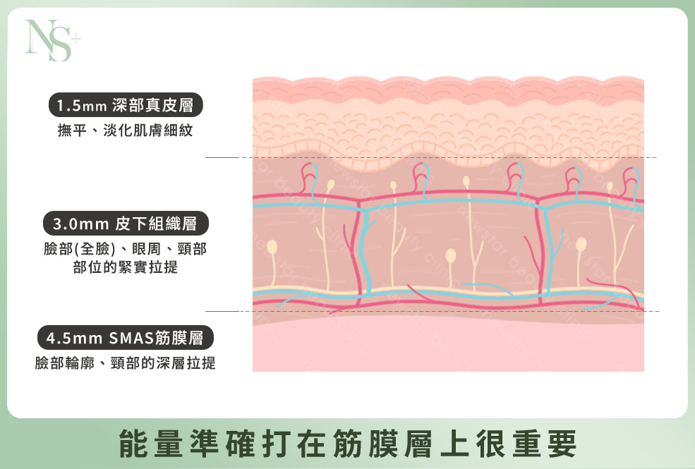 音波拉提_4格_筋膜位置001-1