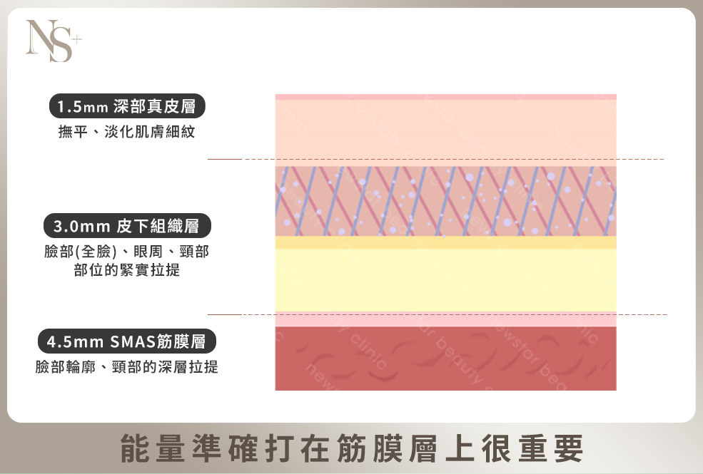 4格(咖啡)_精準打在筋膜層上