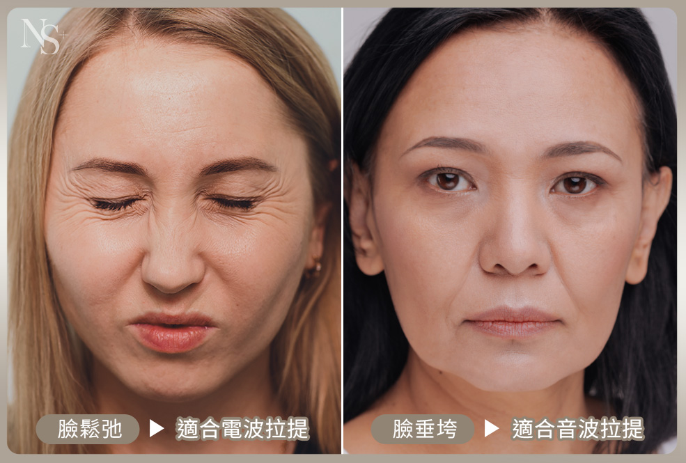 臉部鬆弛下垂_咖啡色系