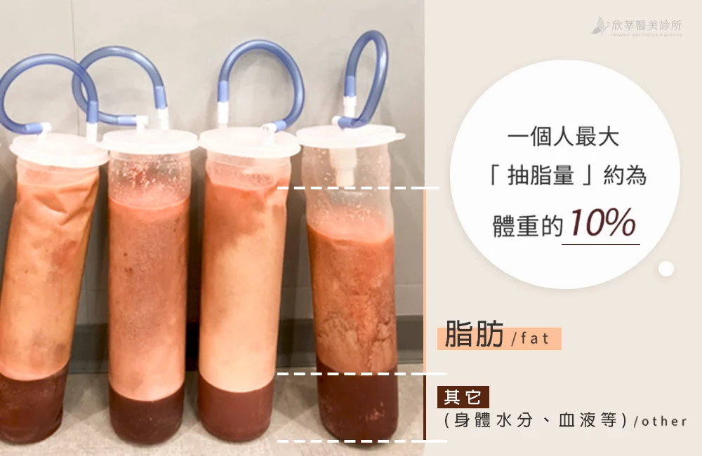 抽脂_抽脂量
