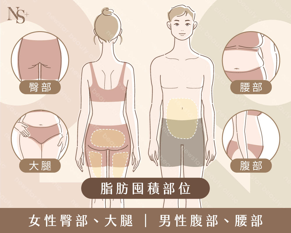 抽脂_脂肪囤積部位
