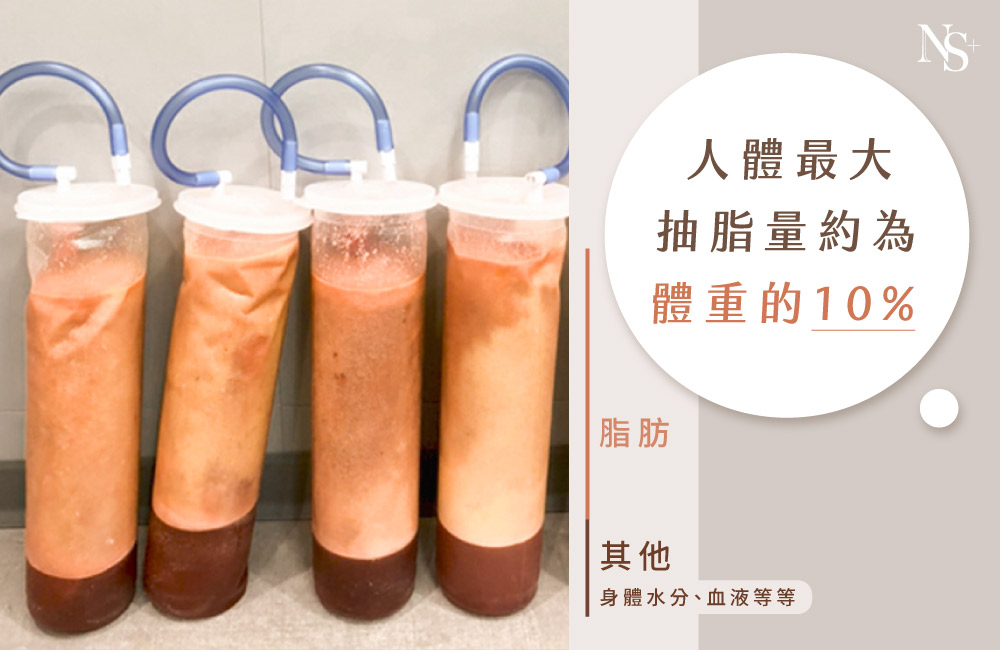 抽脂手術_集脂筒