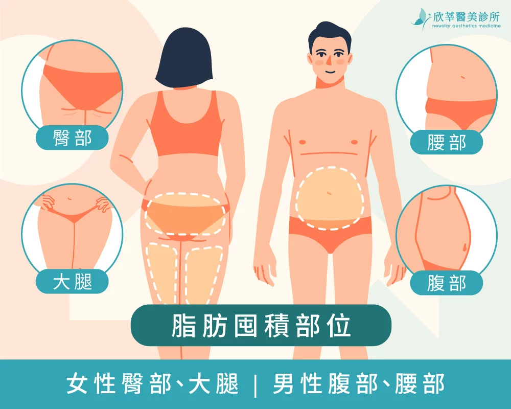 女性脂肪囤積部位：臀部、大腿；男性脂肪囤積部位：腹部、腰部
