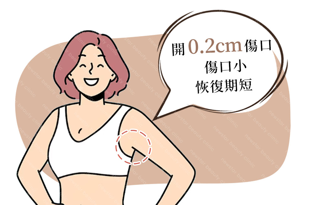 自體脂肪填補_傷口小於0.2cm