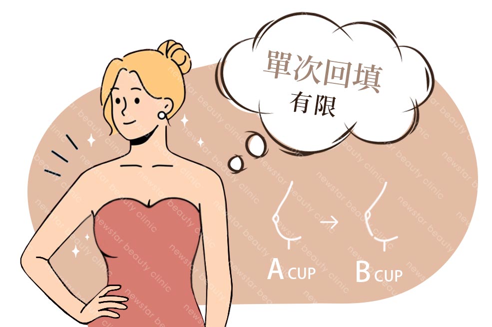 自體脂肪填補_填補次數