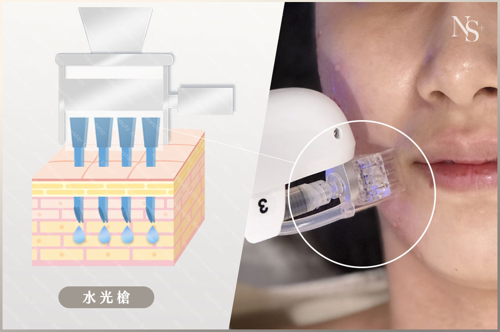 水光槍施打原理(咖啡色)