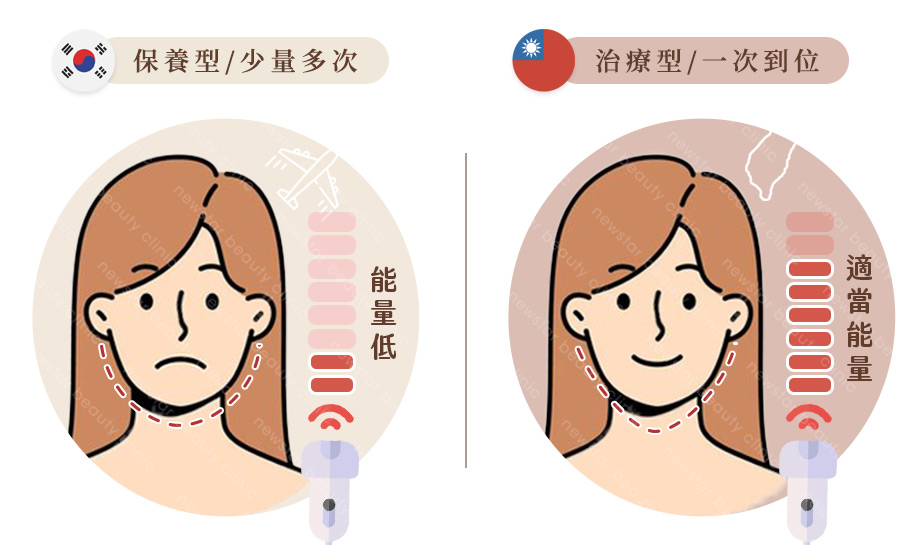 韓國醫美_四大秘密(咖)_治療型態的差異