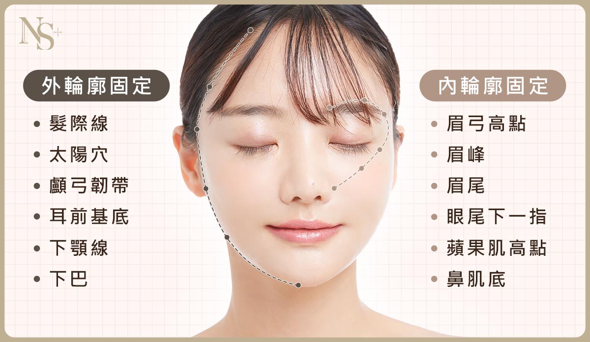 臉部拉提_玻尿酸拉提原理