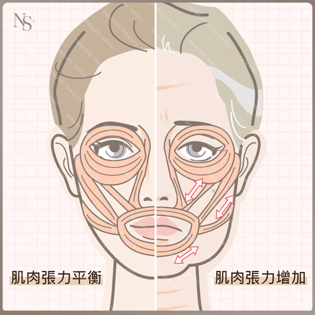 臉部老化_肌肉張力